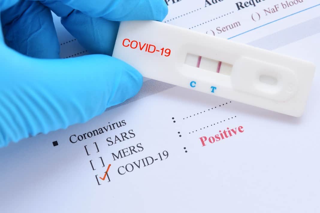 Faites vous dépister à la COVID-19 grâce au test antigénique